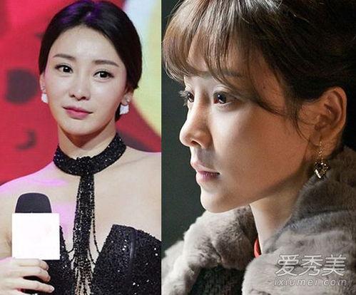 女明星网红整容图片,揭秘美丽背后的秘密